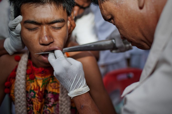 Painful piercing part of the rituals during the Phuket Vegetarian Festival.